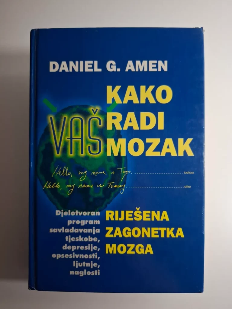 Daniel G. Amen - Kako radi vaš mozak